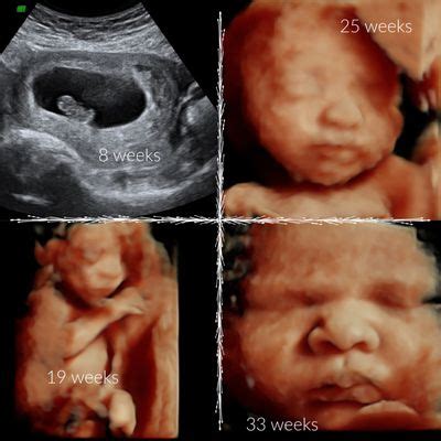 Unique Ultrasound .